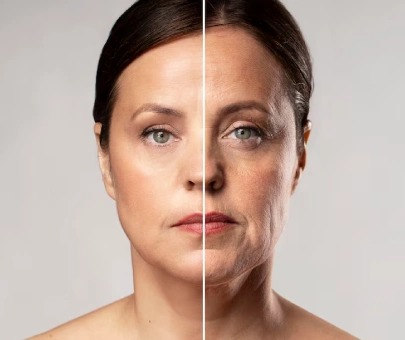 Anti-ageing Treatments