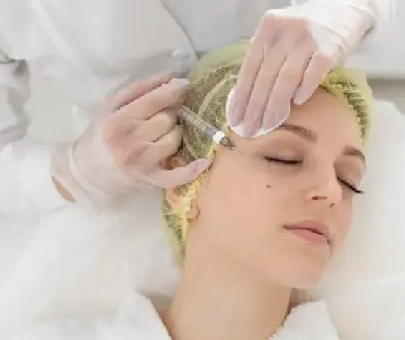 Fillers Treatment
