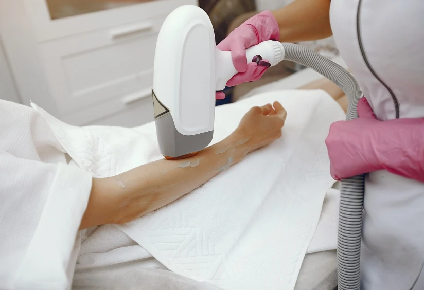 Why Everyone’s Switching to Laser Hair Removal - And You Should Too