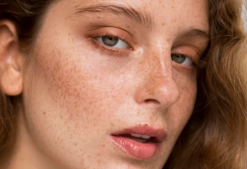 How to Choose the Right Facial for Pigmentation and Dark Spots?