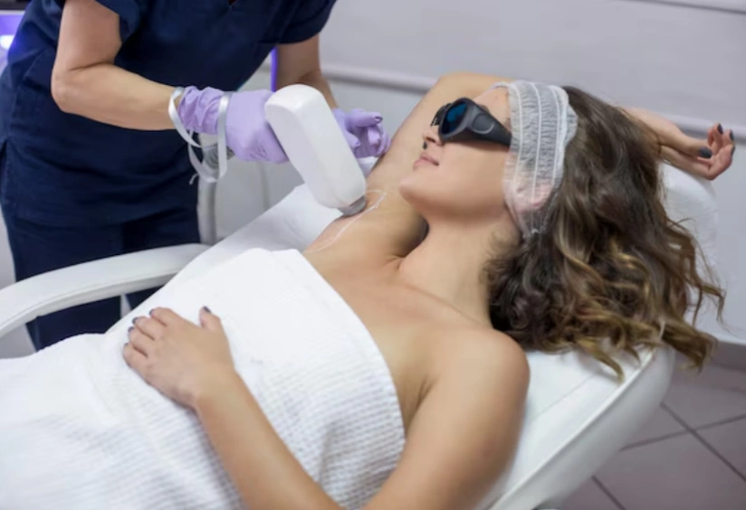 Is Laser Hair Removal Effective for PCOS? Does It Really Work?
