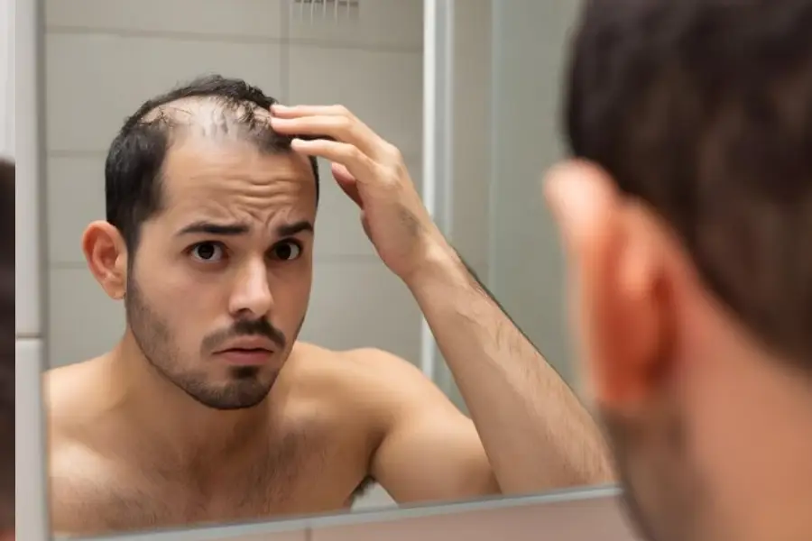 Why Gen Z Men Are Facing Early Hair Loss: Causes & Solutions