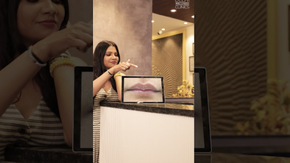 Lip Filler Transformation