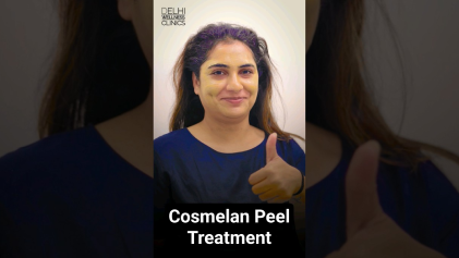 Cosmelan Peel | Chemical Peel Treatment