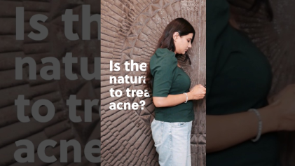 Is There a Natural Way to Treat Acne?