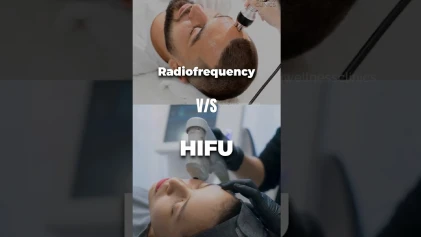 Should you be doing HIFU or radio frequency?