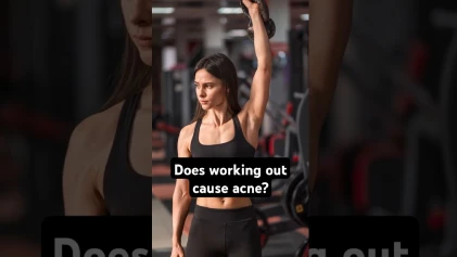 Does Working Out Cause Acne?