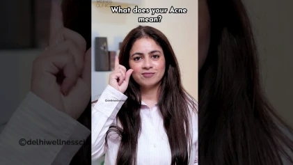 What Your Acne Means By Location According to A Dermatologist