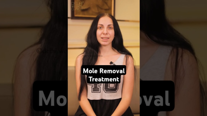 Shasha’s Mole Removal Journey