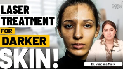 Laser Treatment for Skin Whitening/Lightening | Dr. Vandana Malik | Delhi Wellness Clinics