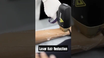 Watch THIS Before Getting Laser Hair Reduction!