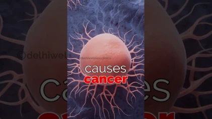 Does Laser Hair Removal Cause Cancer?