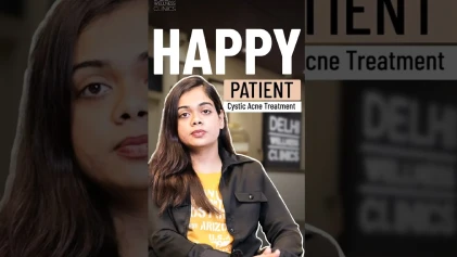 Natasha’s Inspiring Cystic Acne Transformation at Delhi Wellness Clinics