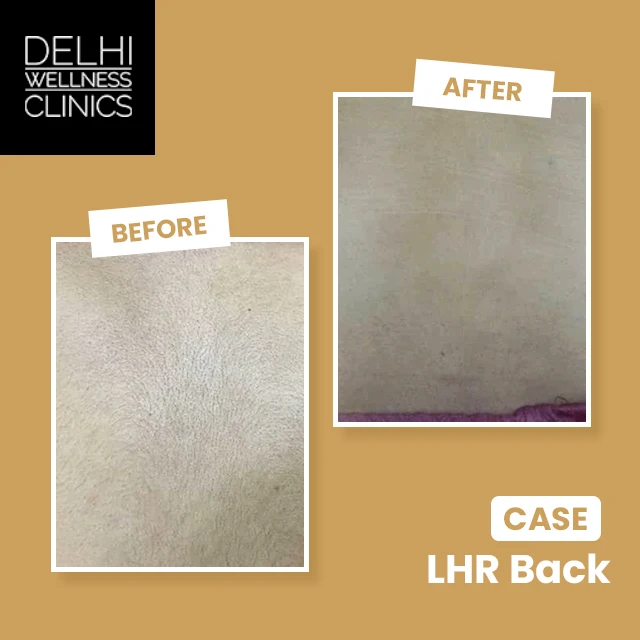 LHR Real Results