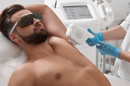Underarms Laser Hair Removal